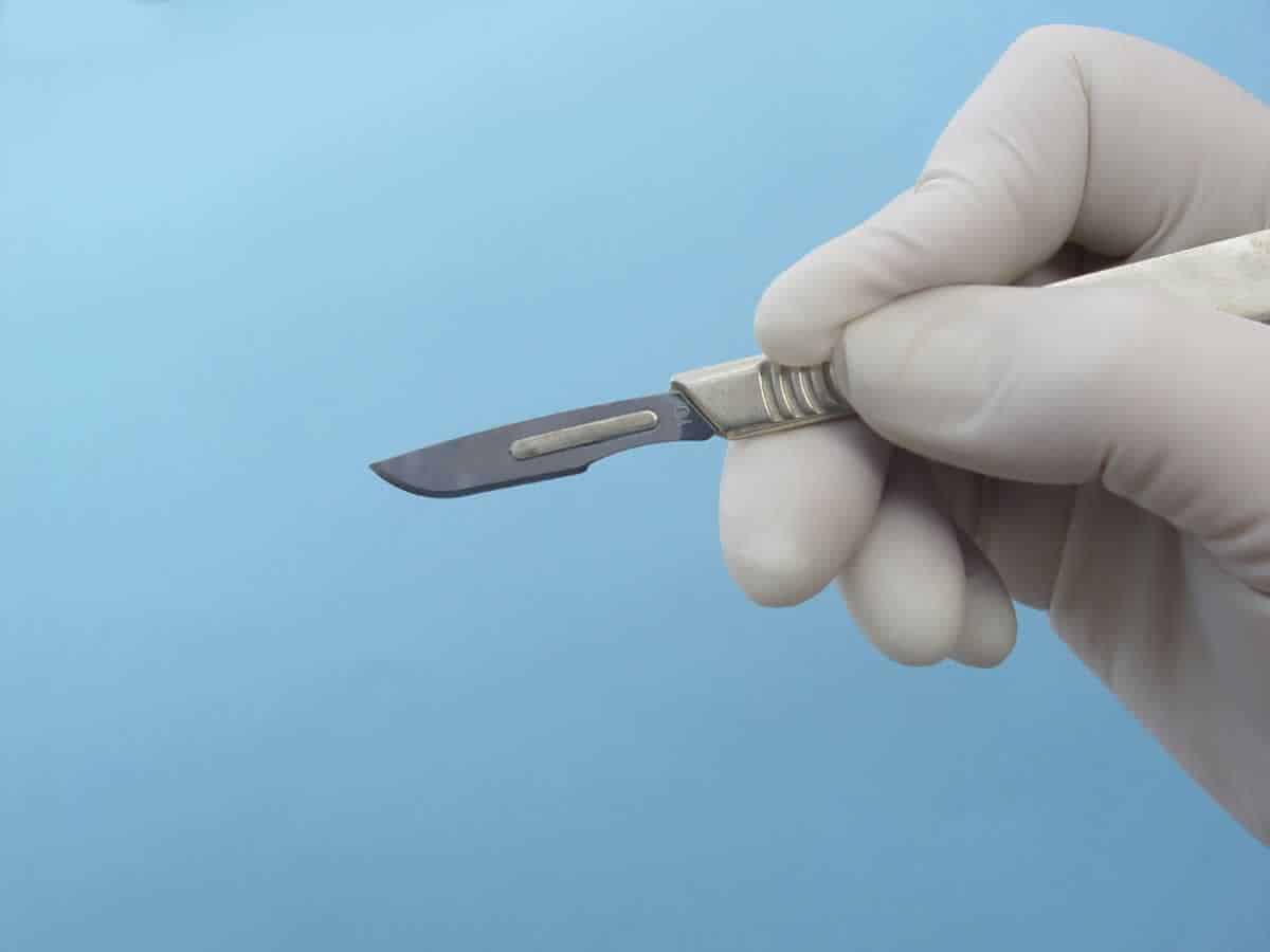 Recupero movimento dopo tenolisi o artrolisi