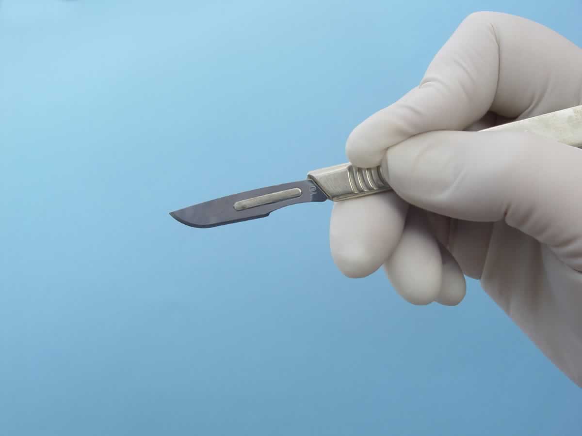 Concetto di aderenze tendinee e rigidità articolare